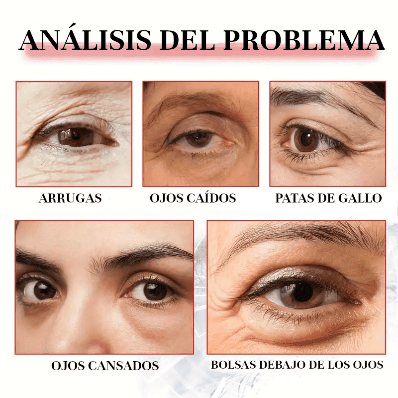 OFERTA 2X1 - Enhancing™ - Di adiós a las ojeras, bolsas, machas y párpados caídos, en solo 2 semanas.