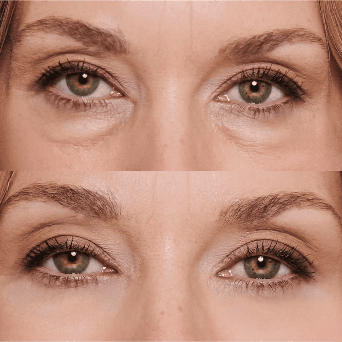 OFERTA 2X1 - Enhancing™ - Di adiós a las ojeras, bolsas, manchas y párpados caídos, en solo 2 semanas.