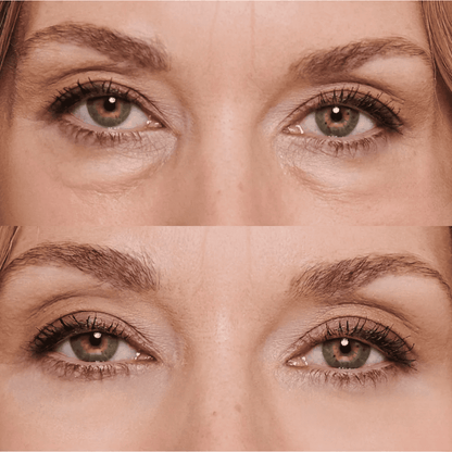 OFERTA 2X1 - Enhancing™ - Di adiós a las ojeras, bolsas, manchas y párpados caídos, en solo 2 semanas.