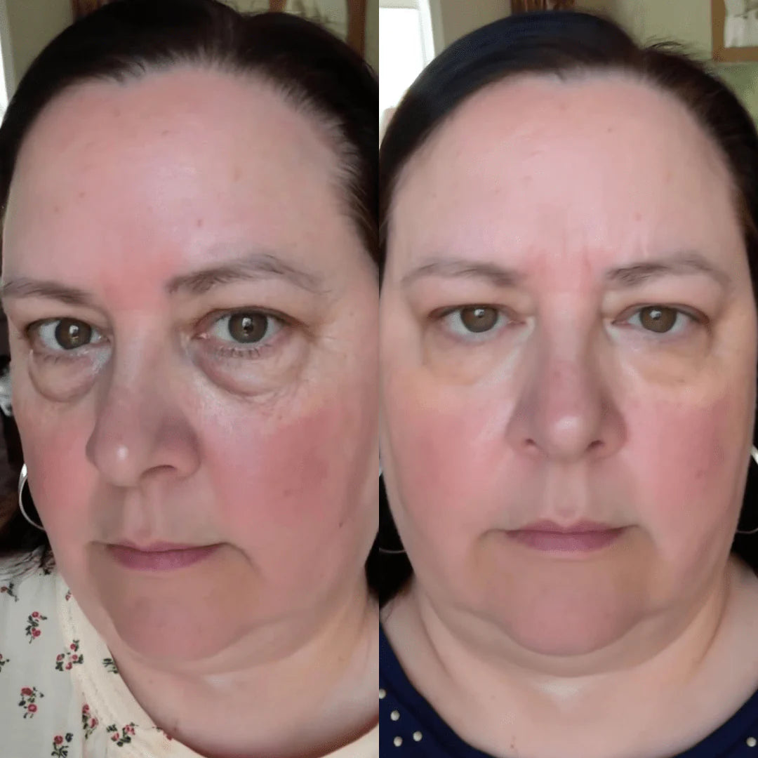 OFERTA 2X1 - Embrujo Enhancing™ - Di adiós a las ojeras, bolsas, manchas y párpados caídos, en solo 2 semanas.