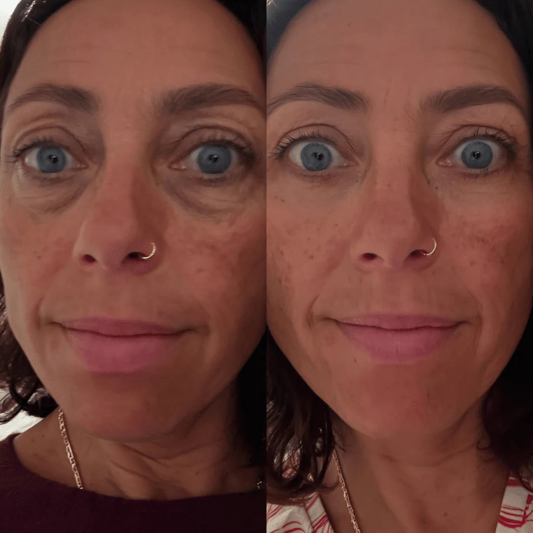 OFERTA 2X1 - Embrujo Enhancing™ - Di adiós a las ojeras, bolsas, manchas y párpados caídos, en solo 2 semanas.