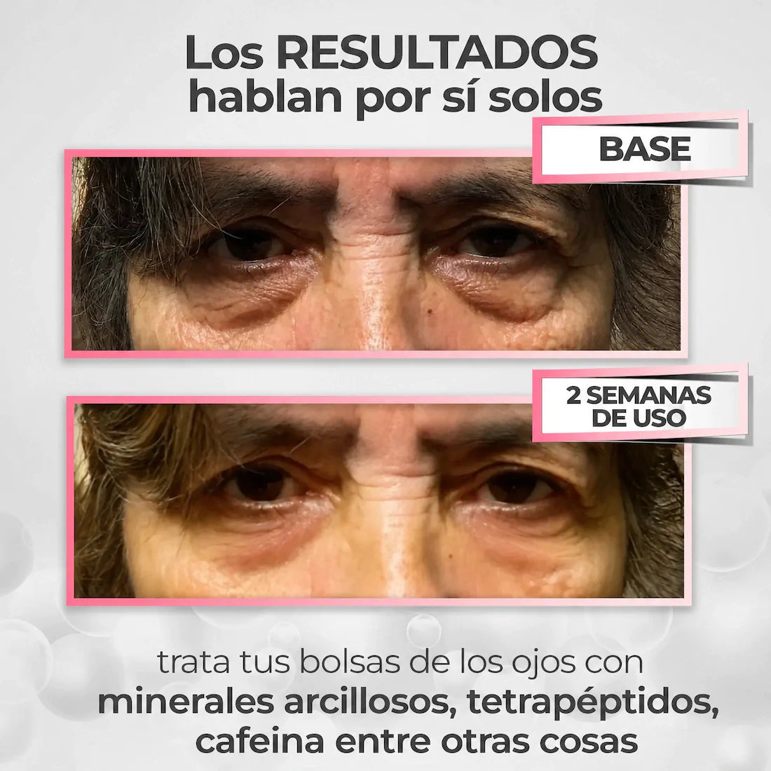 OFERTA 2X1 - Embrujo Enhancing™ - Di adiós a las ojeras, bolsas, manchas y párpados caídos, en solo 2 semanas.