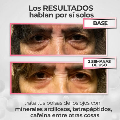 OFERTA 2X1 - Embrujo Enhancing™ - Di adiós a las ojeras, bolsas, manchas y párpados caídos, en solo 2 semanas.