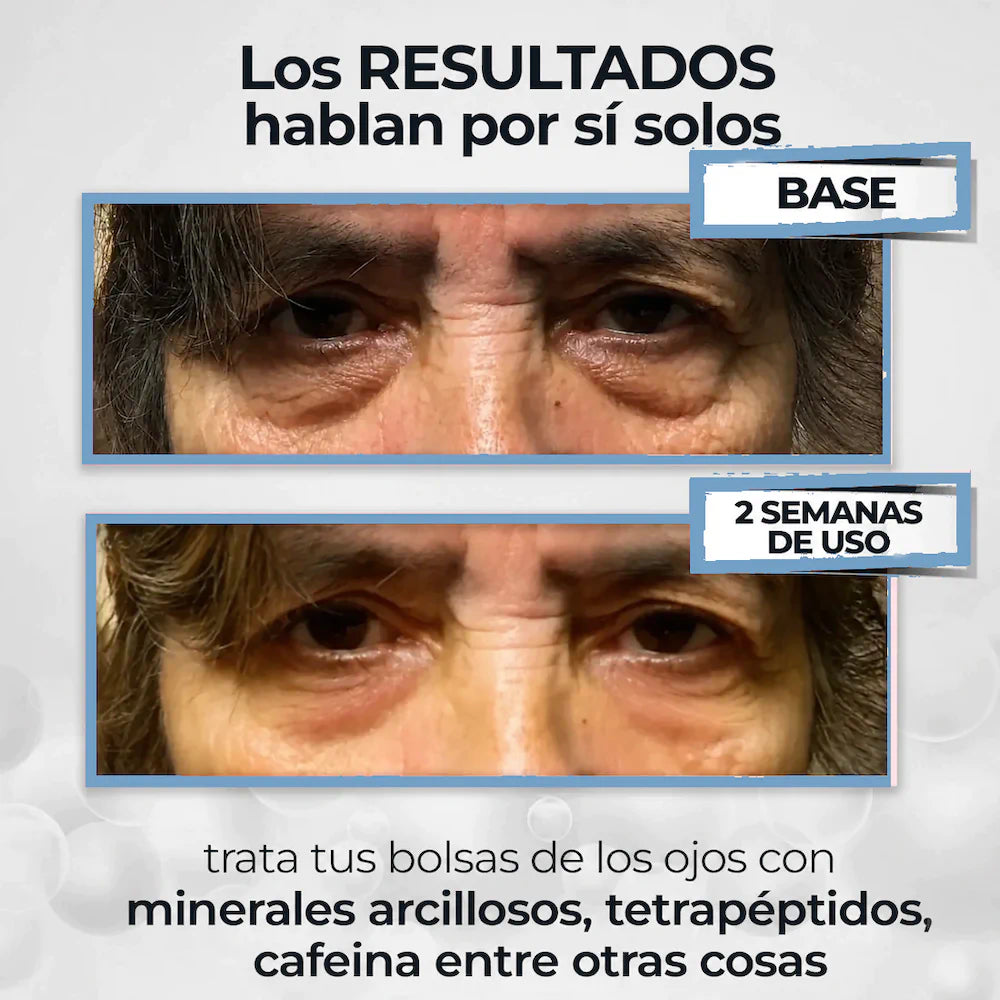 OFERTA 2X1 - Enhancing Eye™ - Di adiós a las ojeras, bolsas, manchas y párpados caídos, en solo 2 semanas.