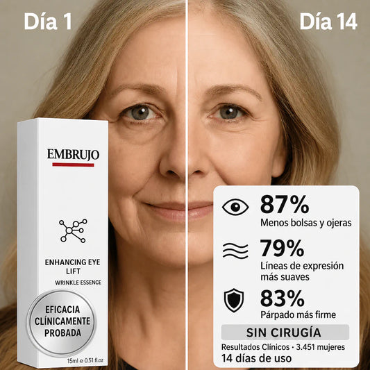 OFERTA 2X1 - Embrujo Enhancing™ - Di adiós a las ojeras, bolsas, manchas y párpados caídos, en solo 2 semanas.
