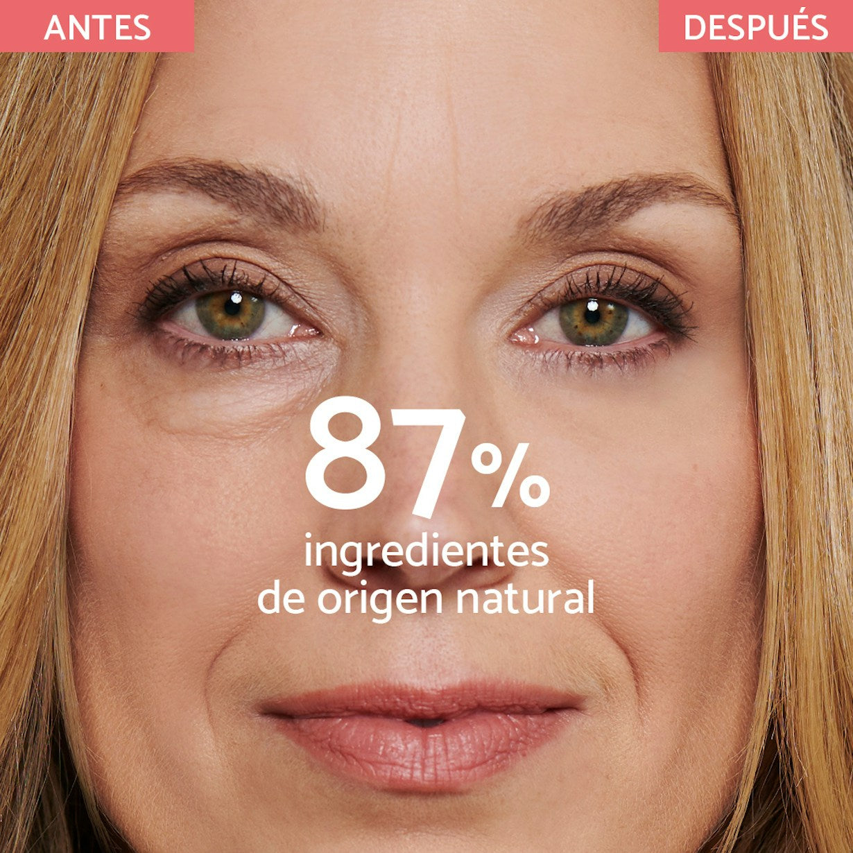 Enhancing Eye Lift