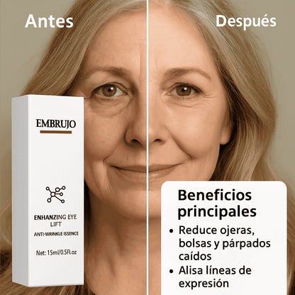 OFERTA 2X1 - Enhancing™ - Di adiós a las ojeras, bolsas, manchas y párpados caídos, rápidamente.