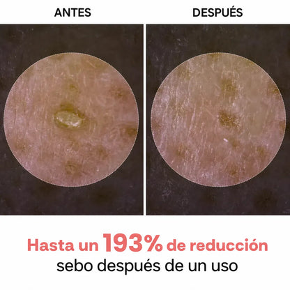 OFERTA 2X1 Adiós Puntos Negros, Mascarilla Purificante Natural.
