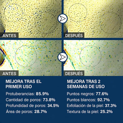 OFERTA 2X1 Adiós Puntos Negros, Mascarilla Purificante Natural.